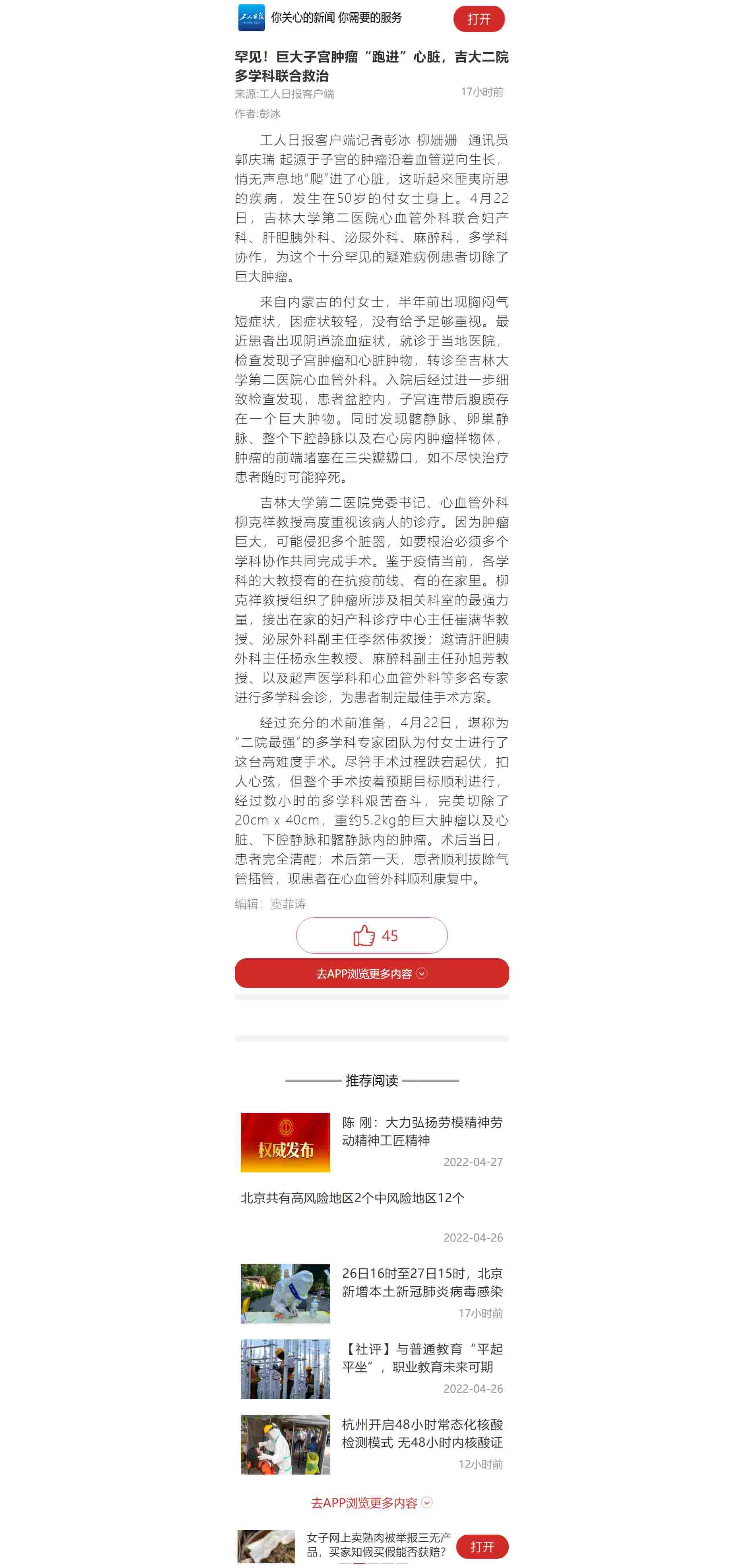 【工人日报】罕见！巨大子宫肿瘤“跑进”心脏，吉大二院多学科联合救治.jpg