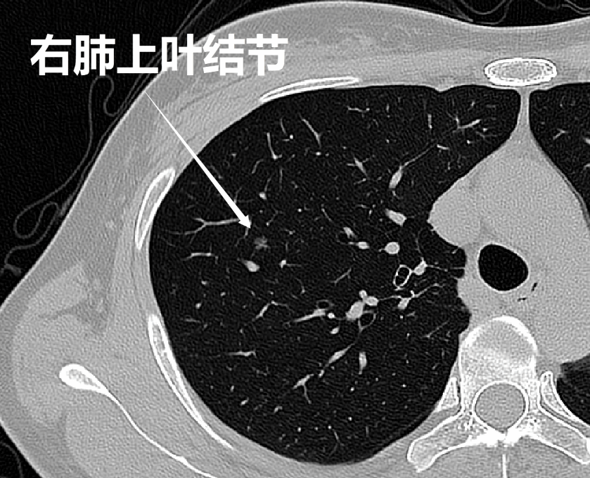 图片 2.png