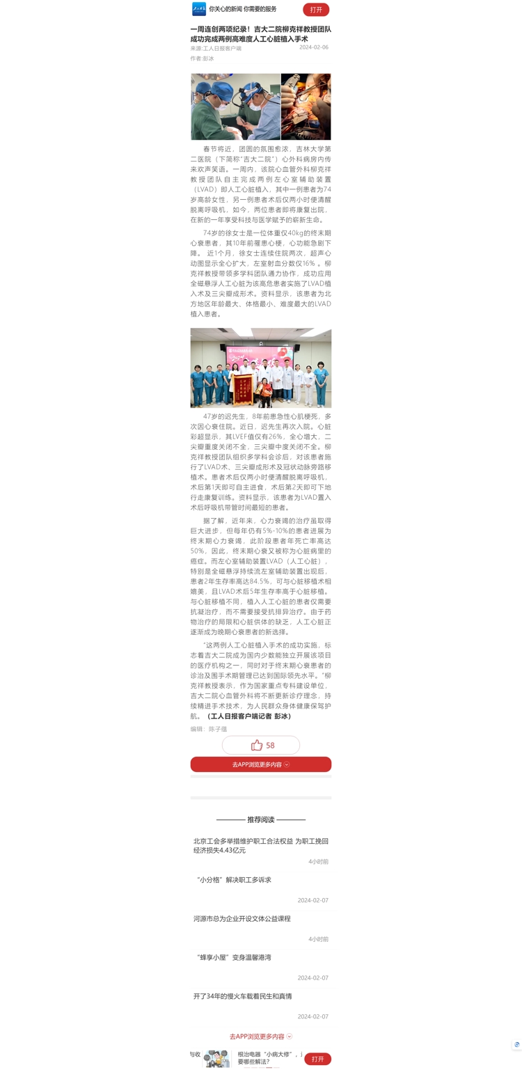 【工人日报】一周连创两项纪录！吉大二院柳克祥教授团队成功完成两例高难度人工心脏植入手术.jpg