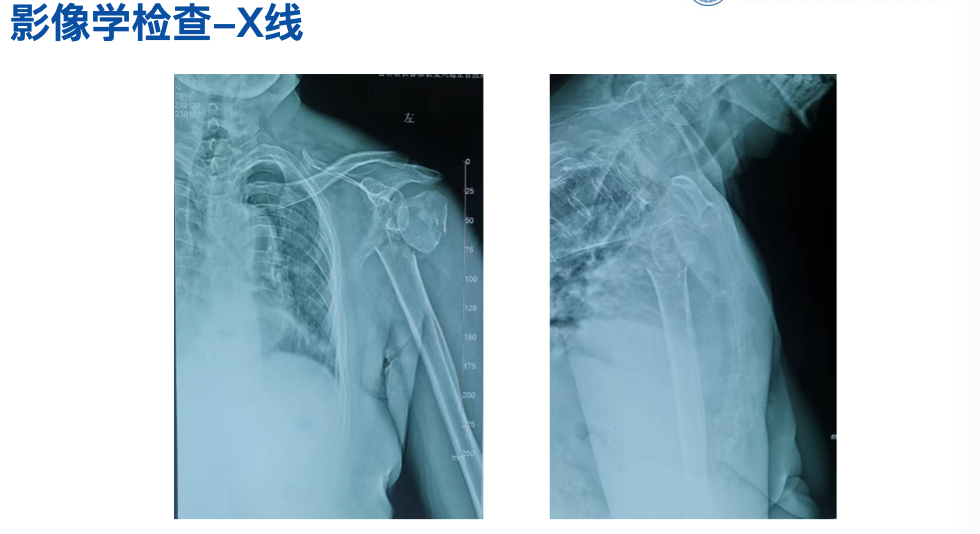 图片 5.png