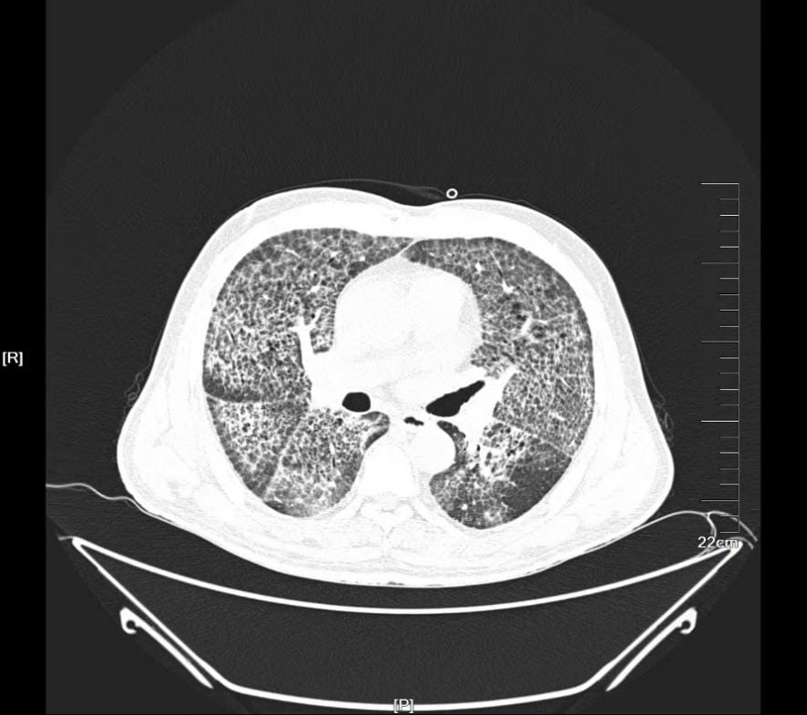 图片 4.jpg 图片 4.jpg