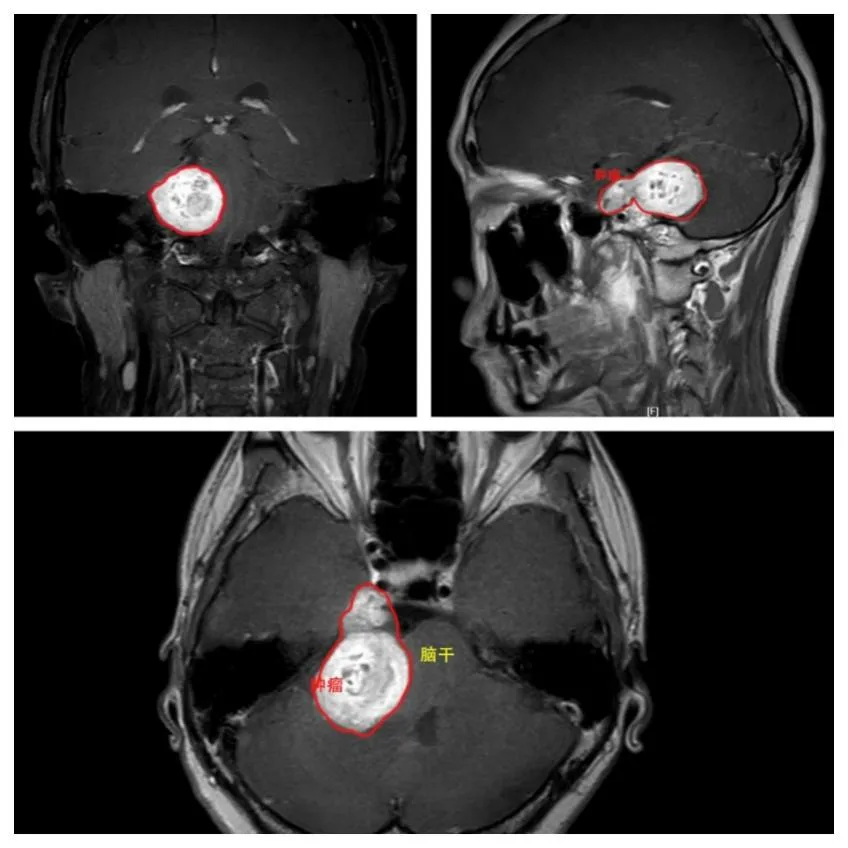 图片 2.png 图片 2.png
